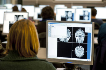 Oorsuizen en Hersenactiviteit